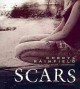 Go to record Scars
